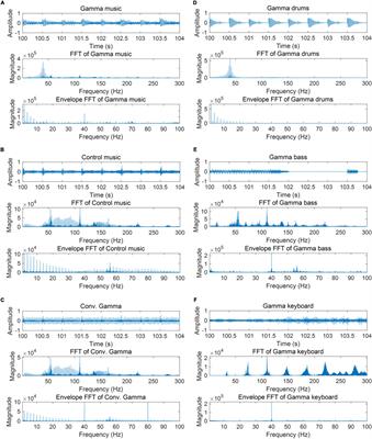 Gamma music: a new acoustic stimulus for gamma-frequency auditory steady-state response